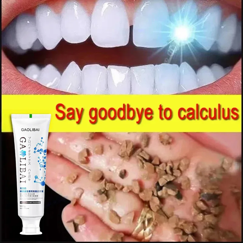 Whitening Teeth Toothpaste Dental Remover Calculus Mouth Odour Removal Bad Breath Preventing Periodontitis Fluoride Toothpaste