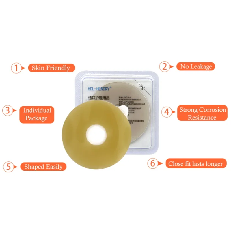 1 buah cincin pasta Ostomy, baseplate Stoma perawatan anti bocor cincin untuk tas Ostomy pembentuk regang untuk mencegah kebocoran melindungi