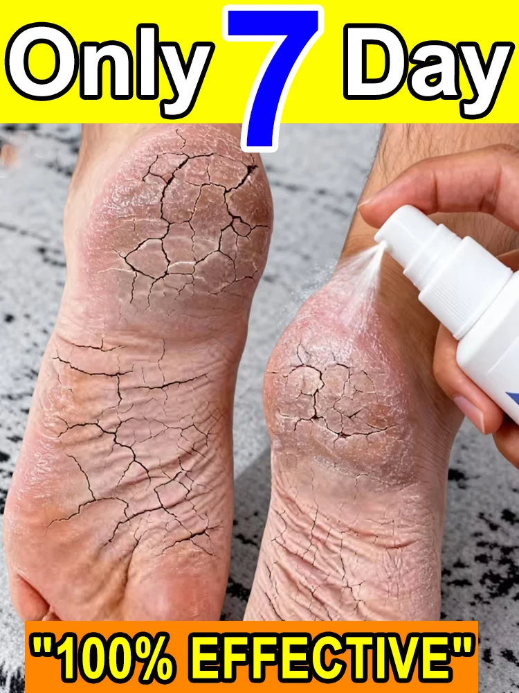 

Hᴇᴀʟɪɴɢ Fᴏᴏᴛ Uʟᴄᴇʀs, Tɪɴᴇᴀ Pᴇᴅɪs, Aɴᴅ Fᴜɴɢᴀʟ Iɴғᴇᴄᴛɪᴏɴs Oғ Tʜᴇ Fᴇᴇᴛ natural ingredients