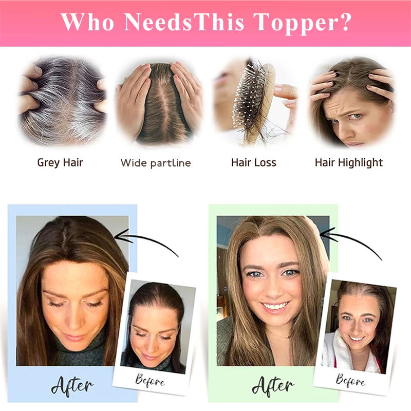 Toppers de cabelo 100% humano, 8-14 polegadas, clipe em postiços, 7x11cm, rede de cabelo de simulação para mulheres com acessórios de cabelo de desbaste