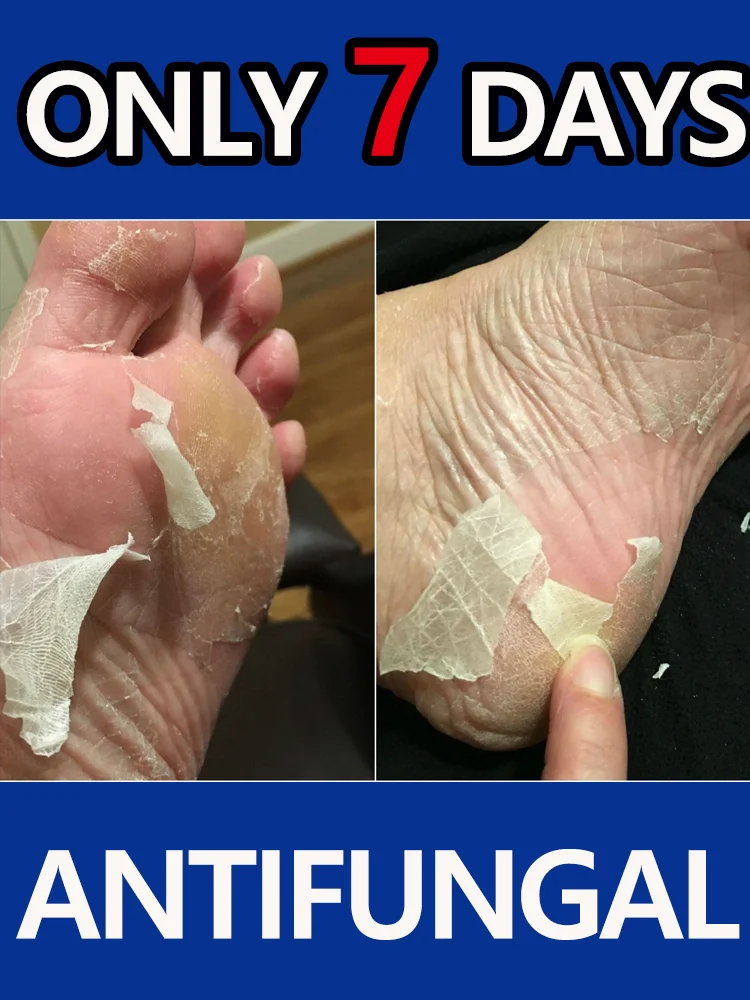 Pʀᴏᴛᴇᴄᴛ ʏᴏᴜʀ ғᴏᴏᴛ ʜᴇᴀʟᴛʜ,Radiate confidence and joy