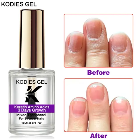 KODIES GEL 네일 성장 최대 네일 강화제, 케라틴 치료 경화제, 건강한 정상 베이스 탑 코트, 수리 시스템, 3 일
