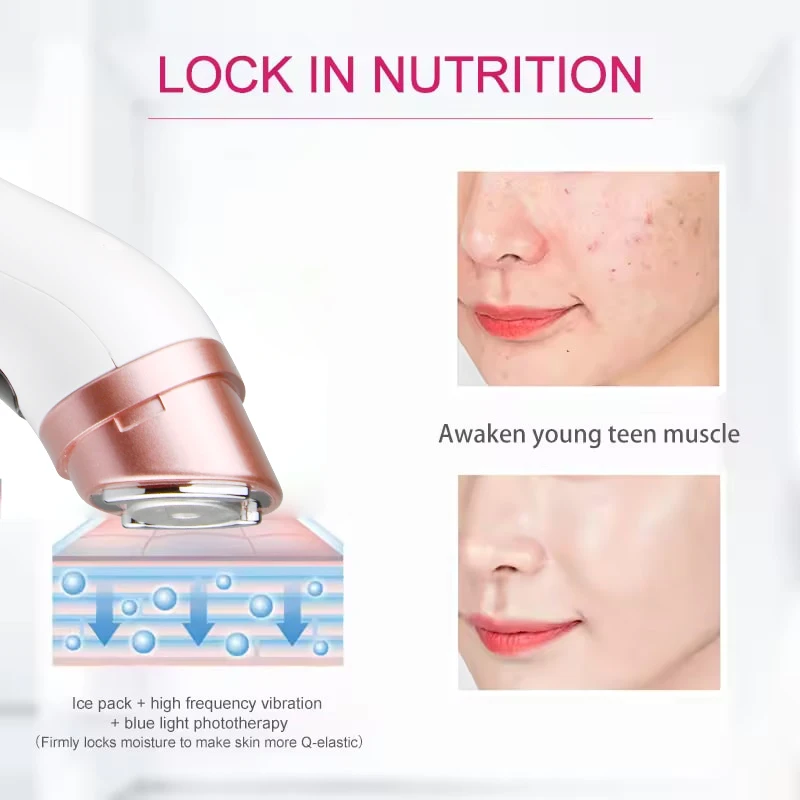جهاز صغير HIFU بالموجات فوق الصوتية EMS جهاز تجميل الوجه مكركرنت لشد العناية بالبشرة أداة مضادة للتجاعيد #3