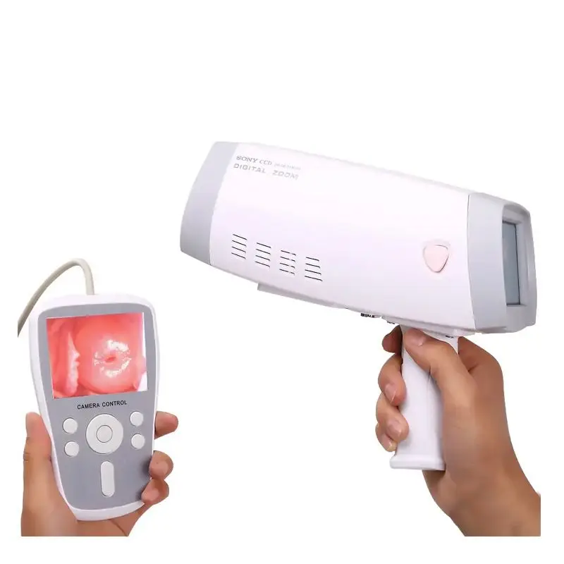 Handheld Portable Digital Colposcope, Electronic Gynecology Vaginal Inspection Diagnostic Instrument