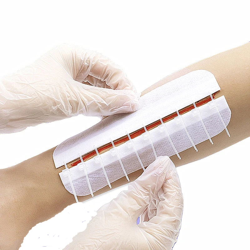 Medical Grade PU Closures | Reusable Adhesive Wound Closure Zipper | Non-invasive Repair fast shipping