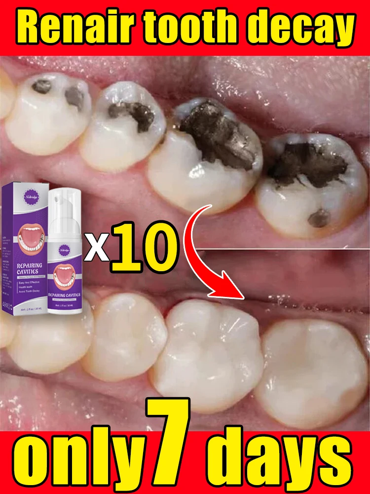 

Solves caries and teeth decay problem