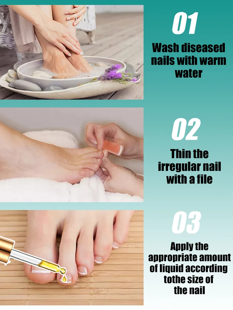 2週間以内に悪いマニキュアは別れを告げる