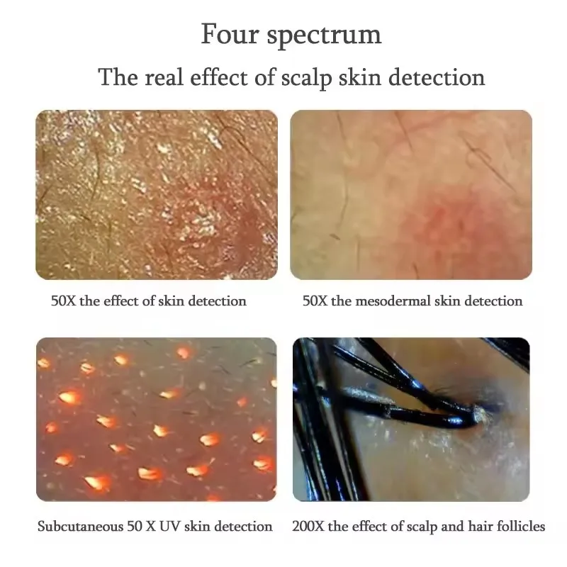 11 Inch Professional High Quality HD Hair Follicles Scalp Scanner Detector Hair Analyzer / Skin And Scalp Hair Analysis Machine