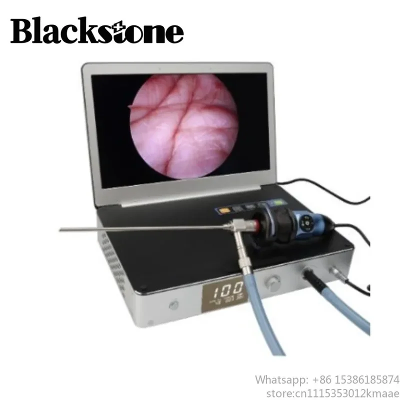 Portable All-in-One 1080P Medical Endoscope Camera System