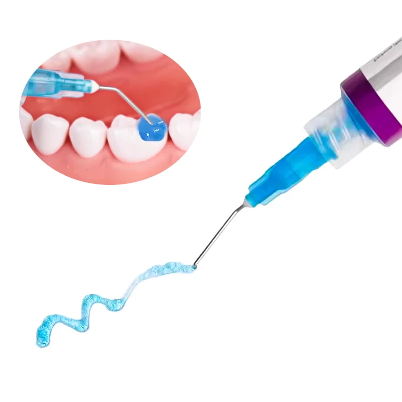 Picture 4: Dental Etchant Gel 37% Phosphoric Acid Etching Gel Orthodontic Adhesive Etching Agent Light Cure Bond For Dentin Enamel Etching