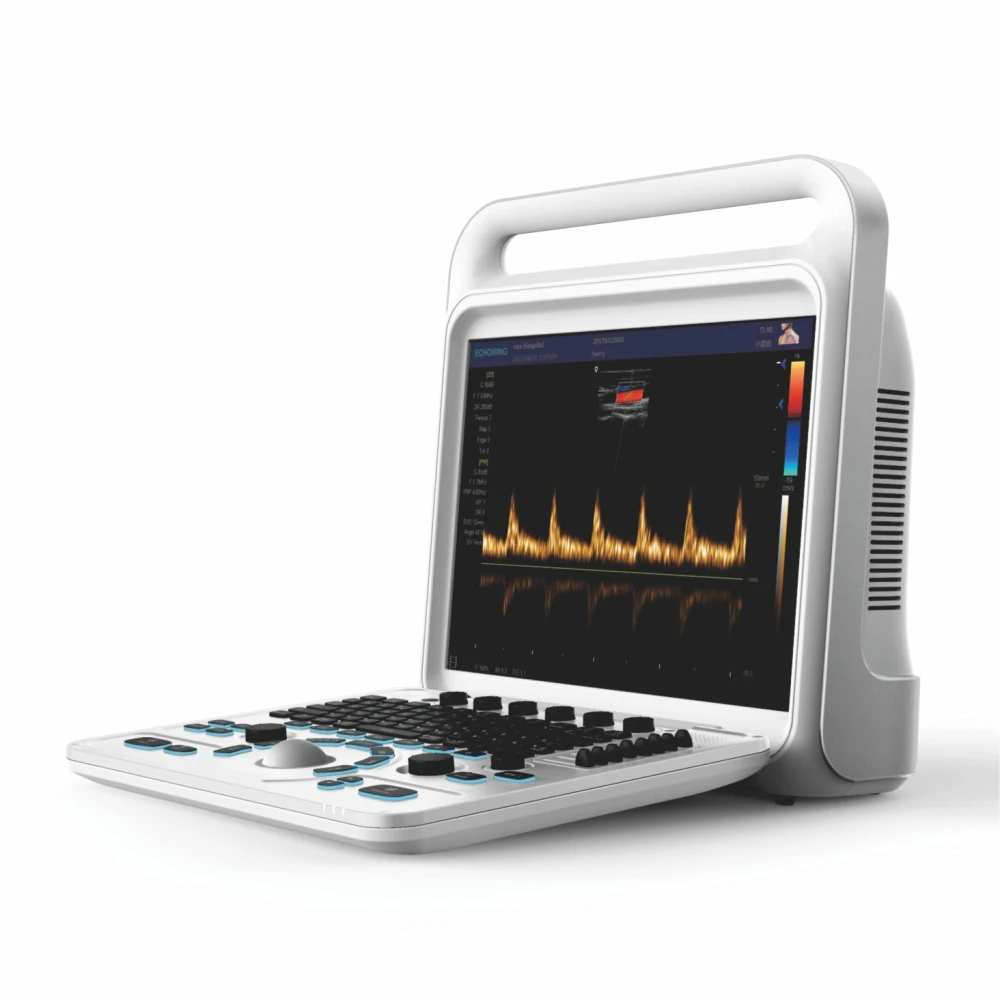 Full Digital Color Doppler System Portable Therapy Equipment Touch Screen  Diagnostic Ultrasound