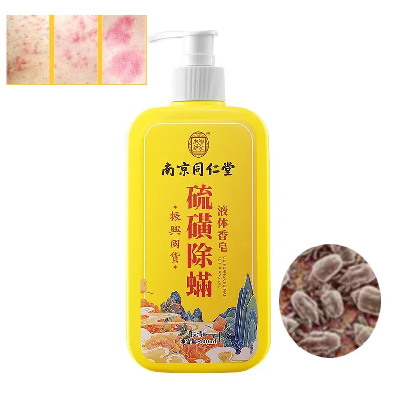 400ml Whitening Body Shower Gels Sulfur Ointment Scabies Mites Fat Bath Sulphur Body Wash Lotion for Itching and Sterilization