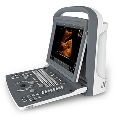 Chison ECO2 Portable B/W Ultrasound Scanner Machine Medical Imaging System Medical Ultrasound Instruments Price