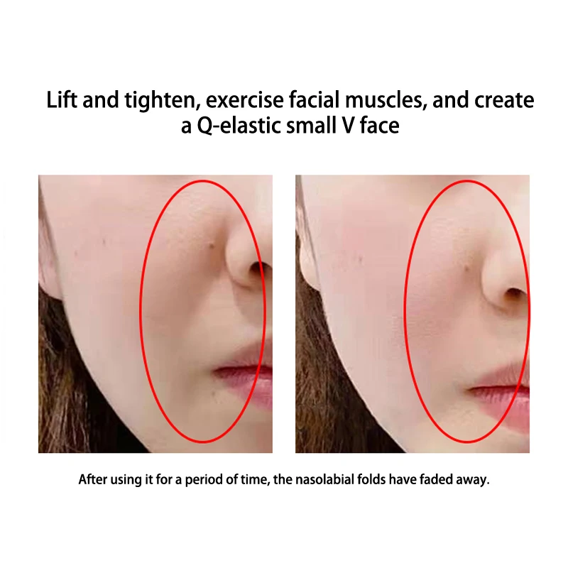 Women Chin Cheek Lift Up Belt Face Bandage V Line Face Strap Skin Beauty Tools Face Lifting Strap Face Slimming Tool