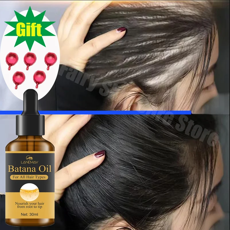 7 Days Fast Batana Oil Hair Growth Serum Anti-loss Hair Regrowth Products Repair Damaged Hair Roots Hair Care For Women Men