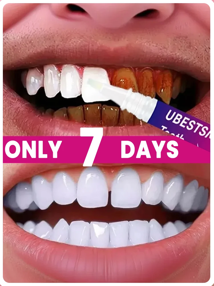 Purple whitening pen, toothpaste for cleaning plaque and removing stains, yellowing teeth, non-sensitive.
