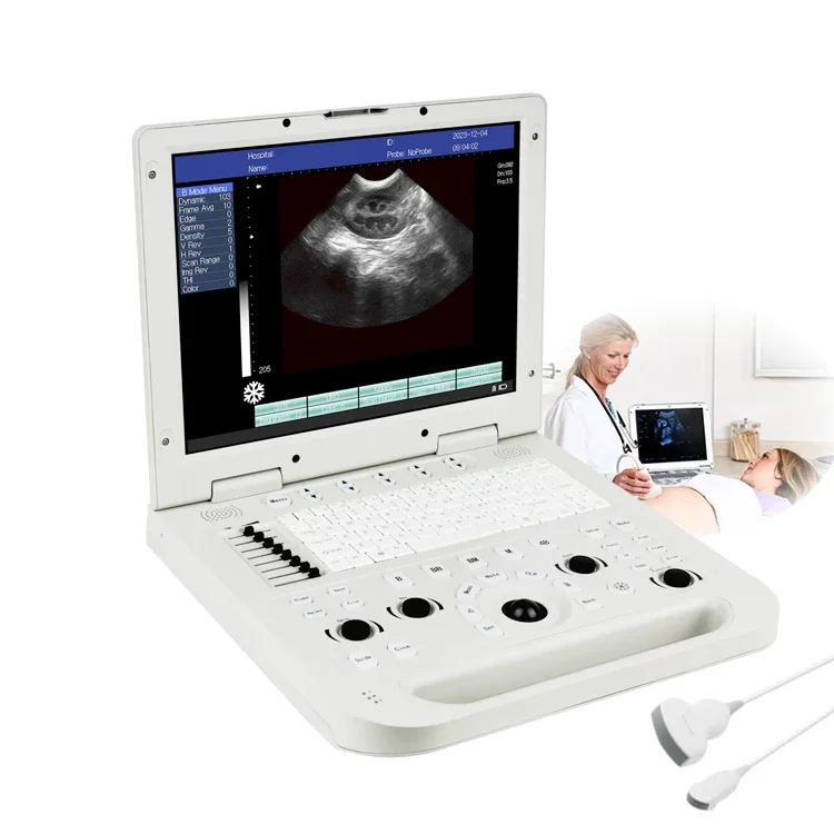 

Medical Echographe Portable Best Price Echographe Portable Real Manufacture Portable Ultrasound