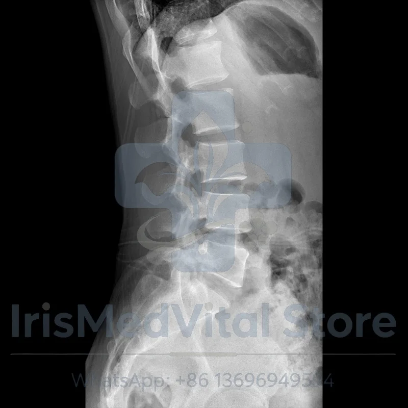 Sainty IND-50kW Dynamic Digital Radiography/Fluoroscopy System-Electric Machinery Class II