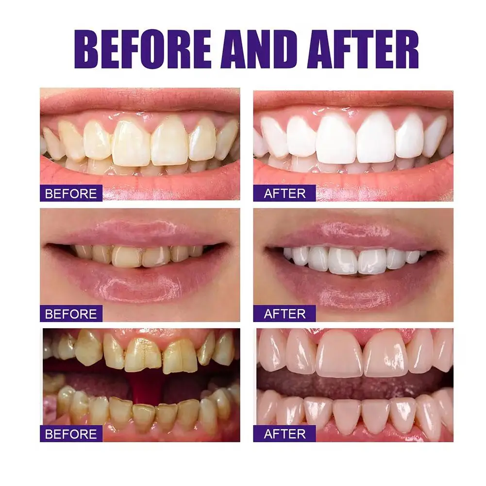 V34 30ml Purple Whitening Toothpaste Remove Stains Reduce Yellowing Care For Teeth Gums Breath Brightening Teeth A9c0