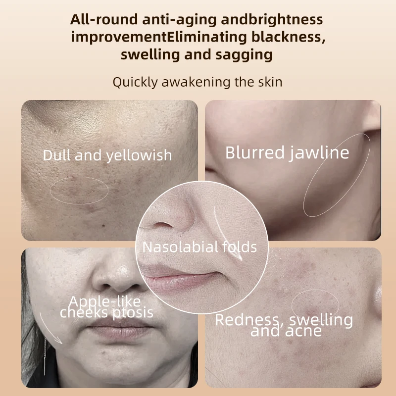 New Heating Roller Facial Device, EMS Vibration Massage Skin Tightening Rotating Microcurrent Facial Massager For Skin Lifting