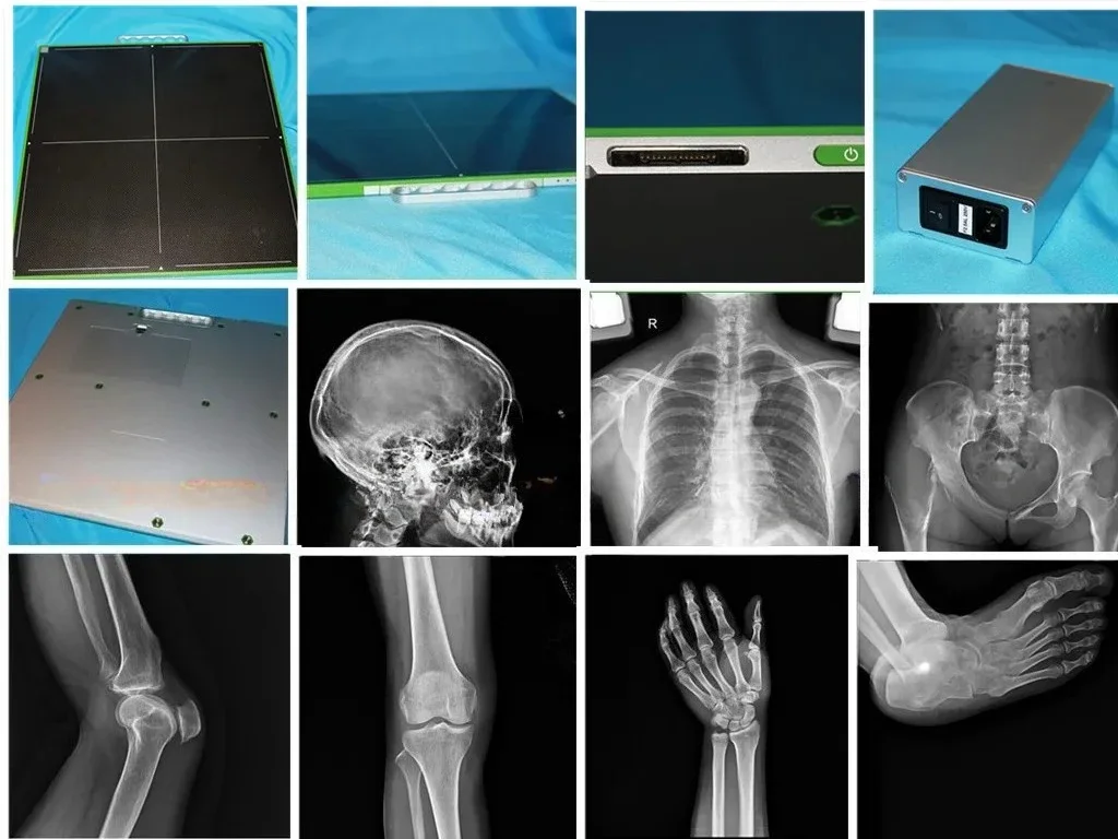 Topverkoop Draadloos 17*17 Xray Flat Panel DR-systeem Flat Panel Detector