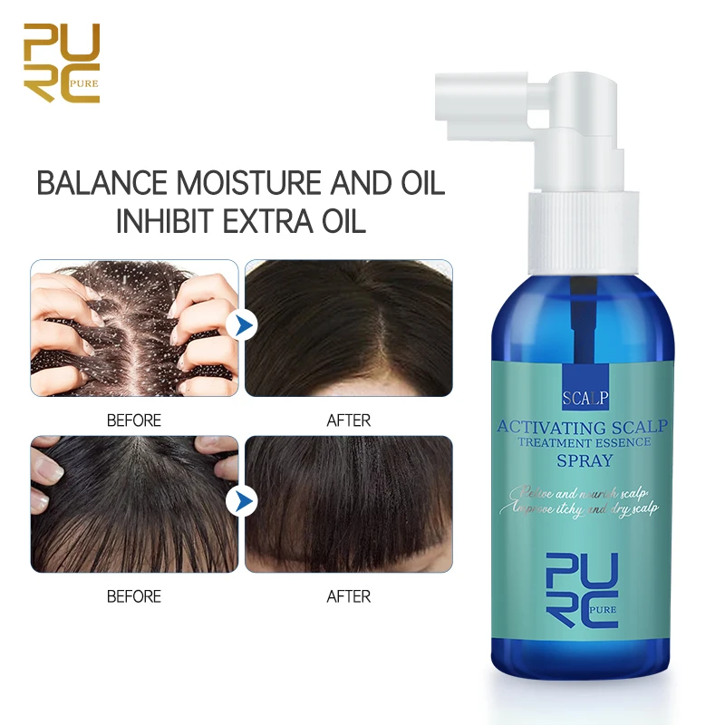 PURC Scalp Treatment Essence Hair Spray Anti-Dandruff Oil Control Anti-Itch Follicle Deep Cleanse Smoothing Hair Care Products
