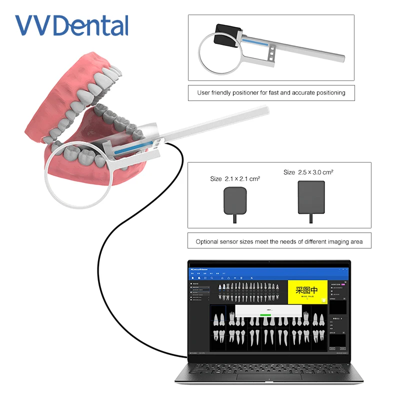 Dental Digital X-Ray Sensor With Holder 2 Year Warranty High-Frequency Intraoral Imaging System with HD Image Radiovisography