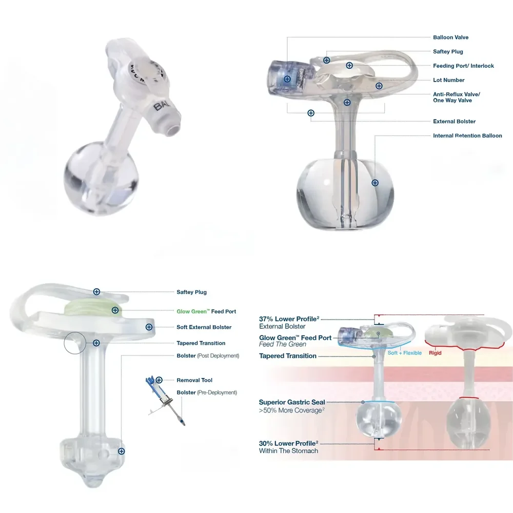 Mini Gastrostomy Button Tube