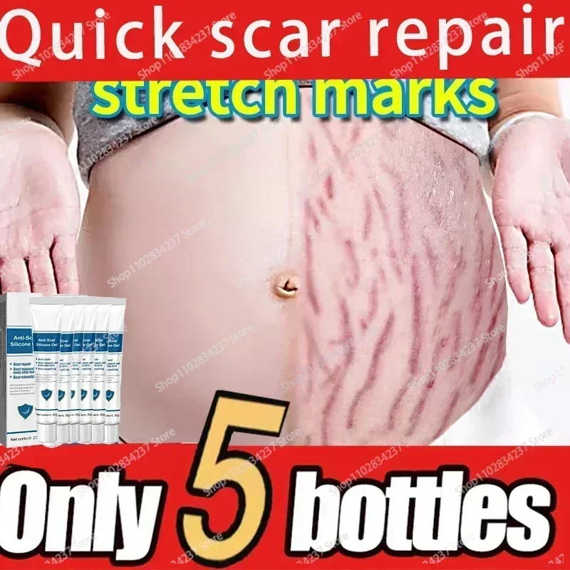 

Eliminate All Red White Old Stretch Marks Cream For Pregnancy Postpartum Skin Care Gel 1006