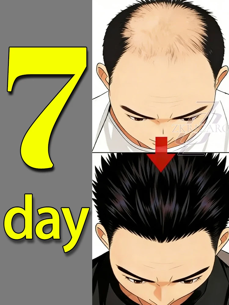 

Scalp massage spray, rapid regeneration, absorbs in 1 second - noticeable results.