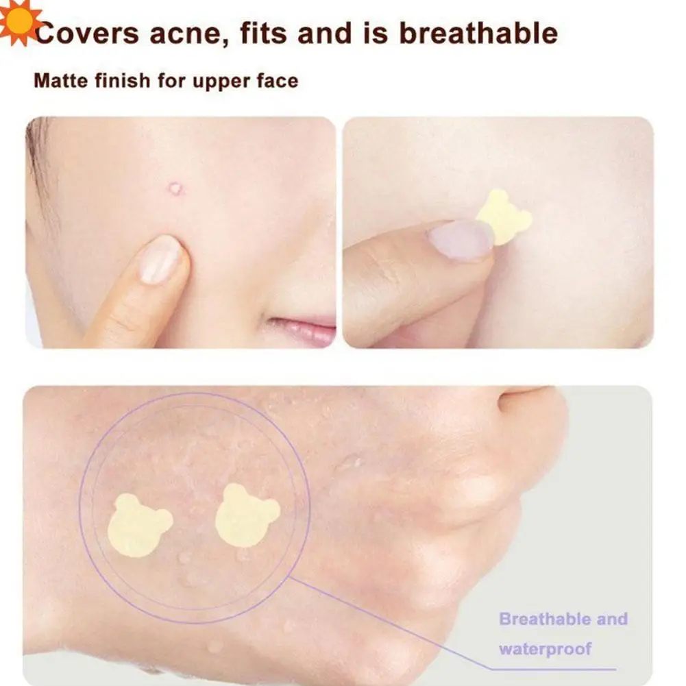 New Acne Pimple Patch Stickers Acne Treatment Pimple Skin Blemish Remover SHEETS 5 Facial Waterproof Care Mask Tool Spot H7A6