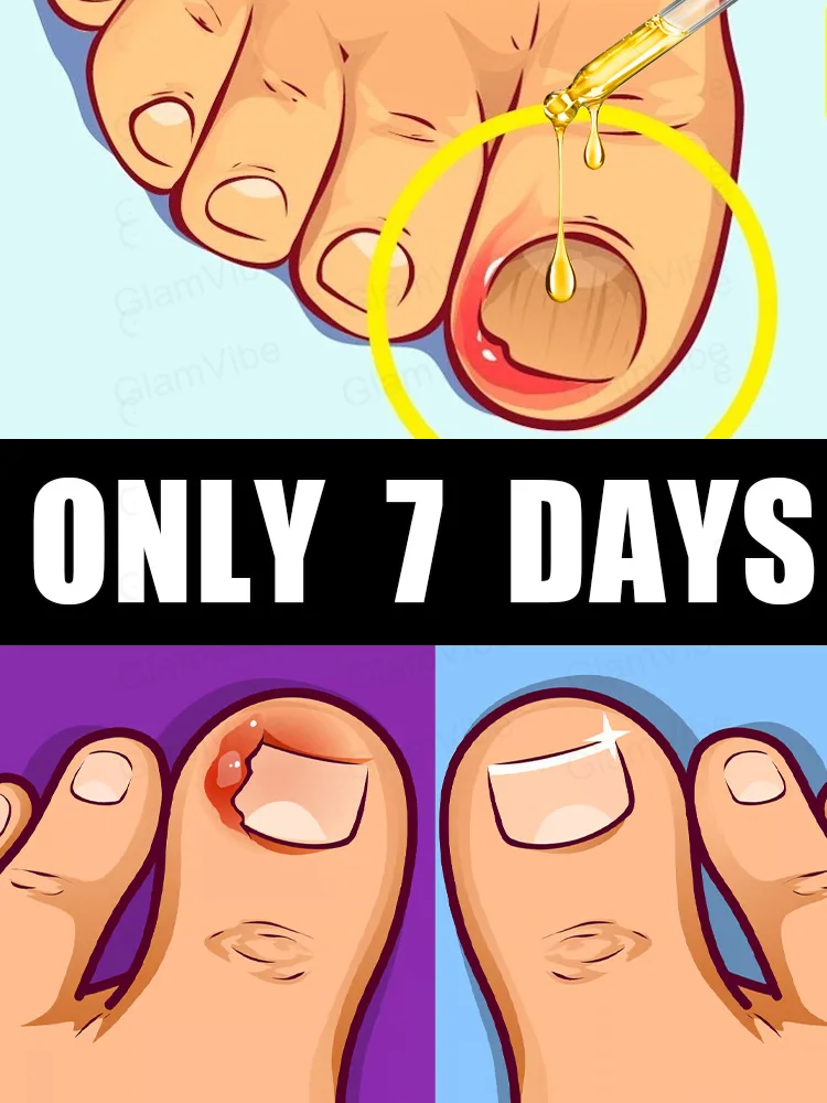 

Simple care to keep your nails clean and neat