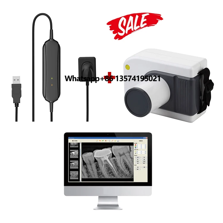 

High Frequency Portable X-ray Unit,digital Xray Sensor Xray