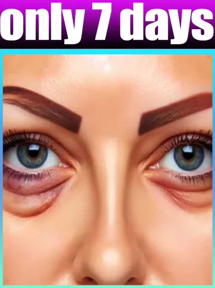 

2025 Eye Patches eye beauty tool suitable for all skin types