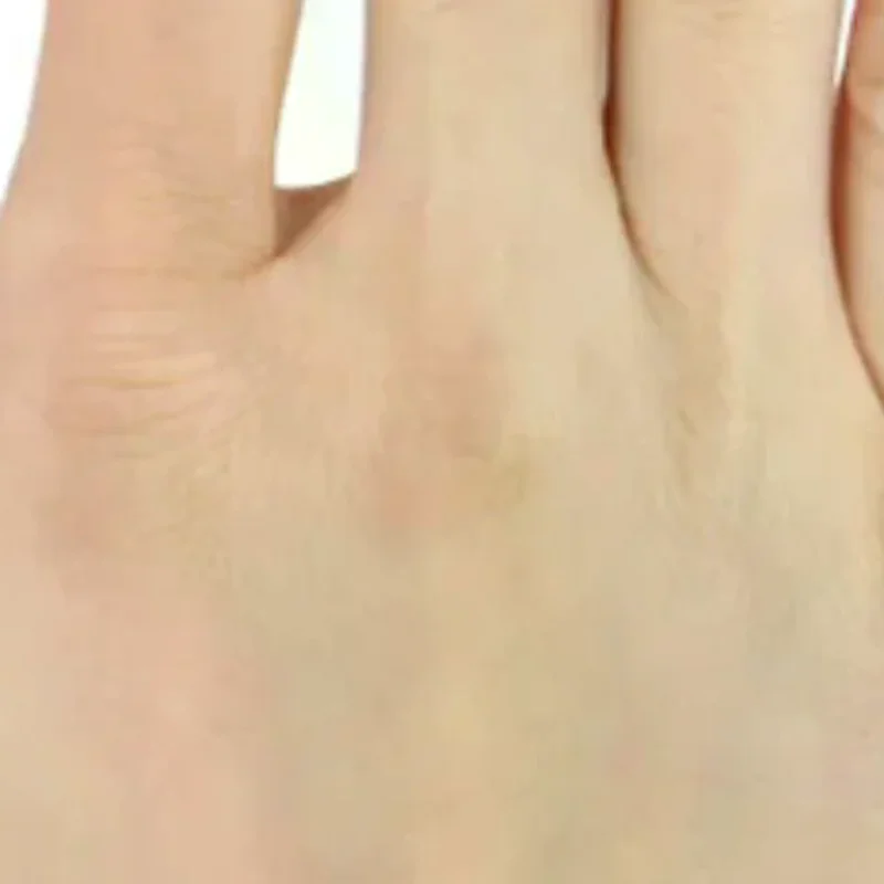 

Silicone Finger Protective Patch Wrapping Compression Waterproof Finger Patch Finger Pain Relief Soft Bandage Breathable