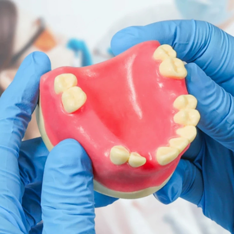 نموذج فقدان الأسنان زرع الأسنان طالب التدريب التدريب المعونة ممارسة نموذج العلوي الفك رفع يزرع استعادة نموذج مختبر