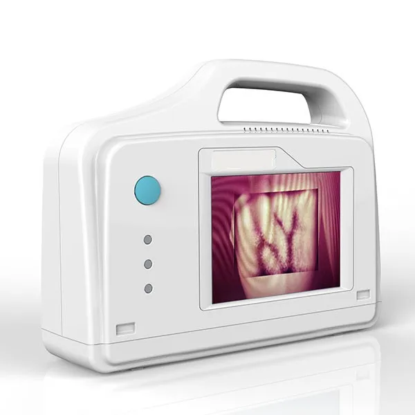 hospital portable infrared vein finder  vein viewing