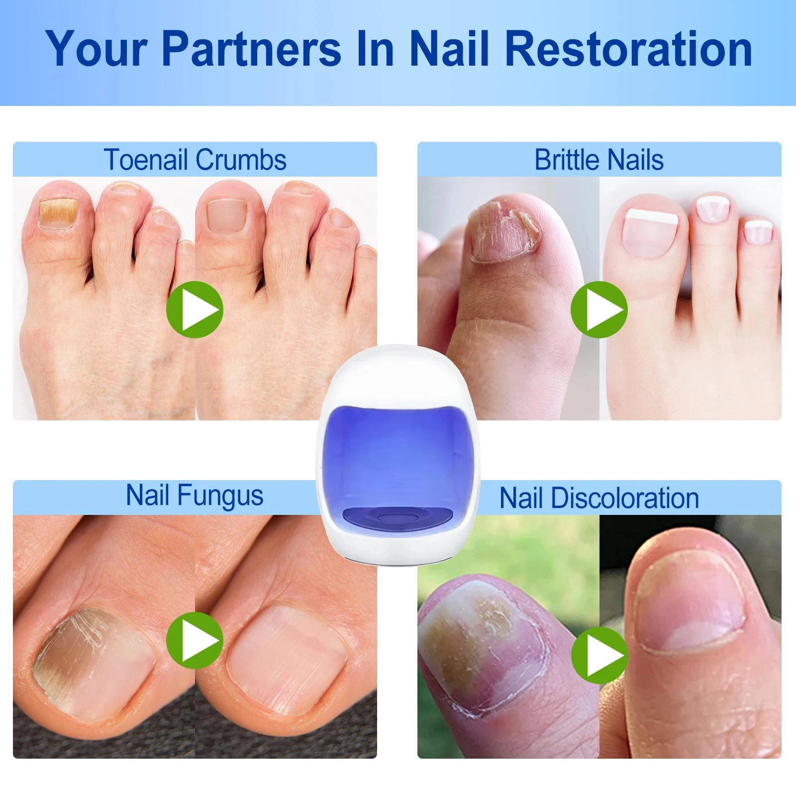 Nail Fungus Laser Treatment Feet Onychomycosis Repair Toenail Nails Device Fingernail Health Care