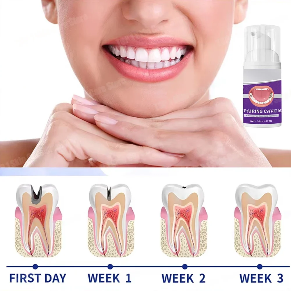 

Tooth Decay Repair Repair All Tooth Decay Cavities and Protect Teeth Whitening Teeth Dental Lab Dental Caries Decayed Teeth