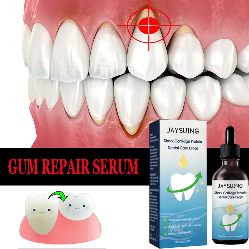 

Rapid Repair Gums Serum Effectively Relieve Tooth Allergy Dental Caries Tooth Cleaning Toothpaste Relieve Tooth Damage Drops
