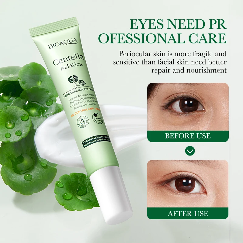 스노우 그라스 영양 공급 및 복구 아이 크림, 잔주름 제거, 눈가 붓기 완화, 눈가 주름 개선, 탄력 강화, 다크서클 완화, 보습 효과 V6J7