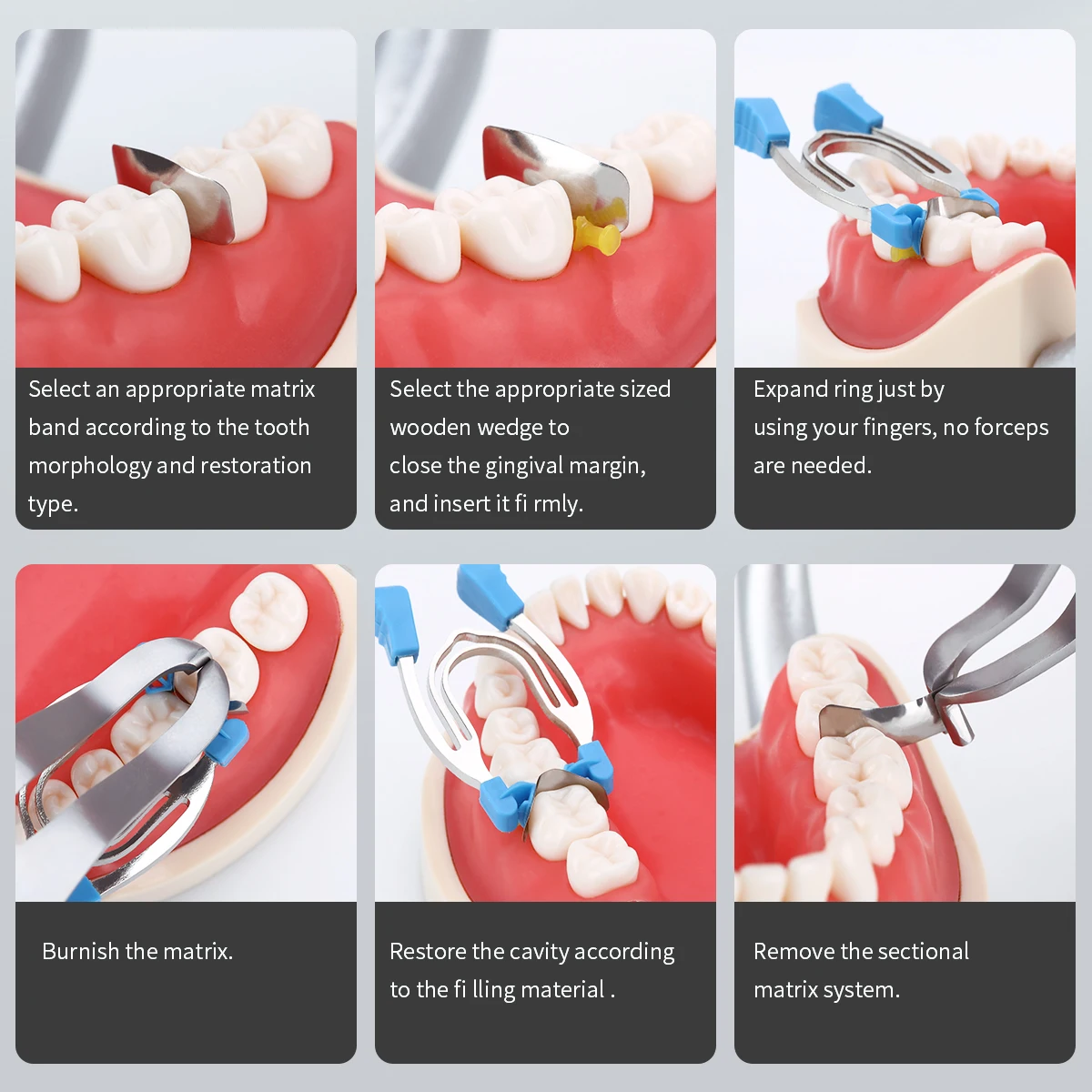 AZDENT Dental Sectional Contoured Matrix Clip Matrices Clamps Wedges The Newest Type Plier With Replacement Parts Dentistry Tool