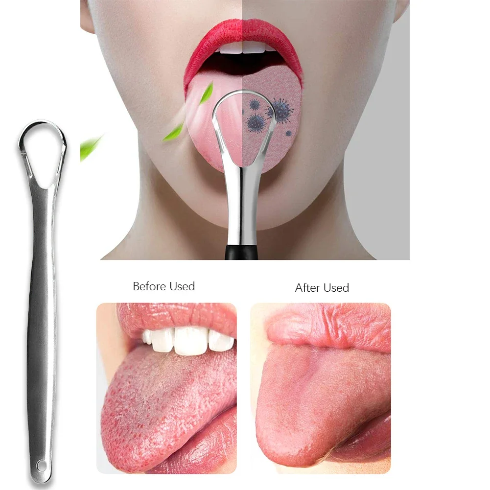 

3Pcs Portable Tongue Scraper Reusable Stainless Steel Oral Hygiene Coating Brush With Case Bad Breath Remover Adult Travel Use