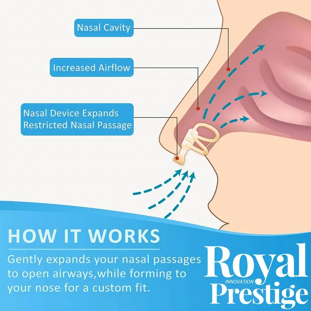 Dilatateur nasal en silicone pour aider au sommeil, dispositif anti-sicing, empêche le sicing et augmente la ories, surpoids de l'air, dilatateur nasal antarctique