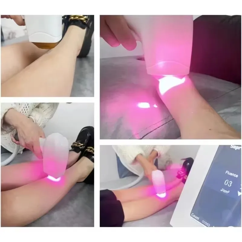 Gelo indolor alexandrite laser permanente removedor de pêlos 755nm 808nm 1064nm diodo laser máquina de remoção de pêlos depilação definitiva