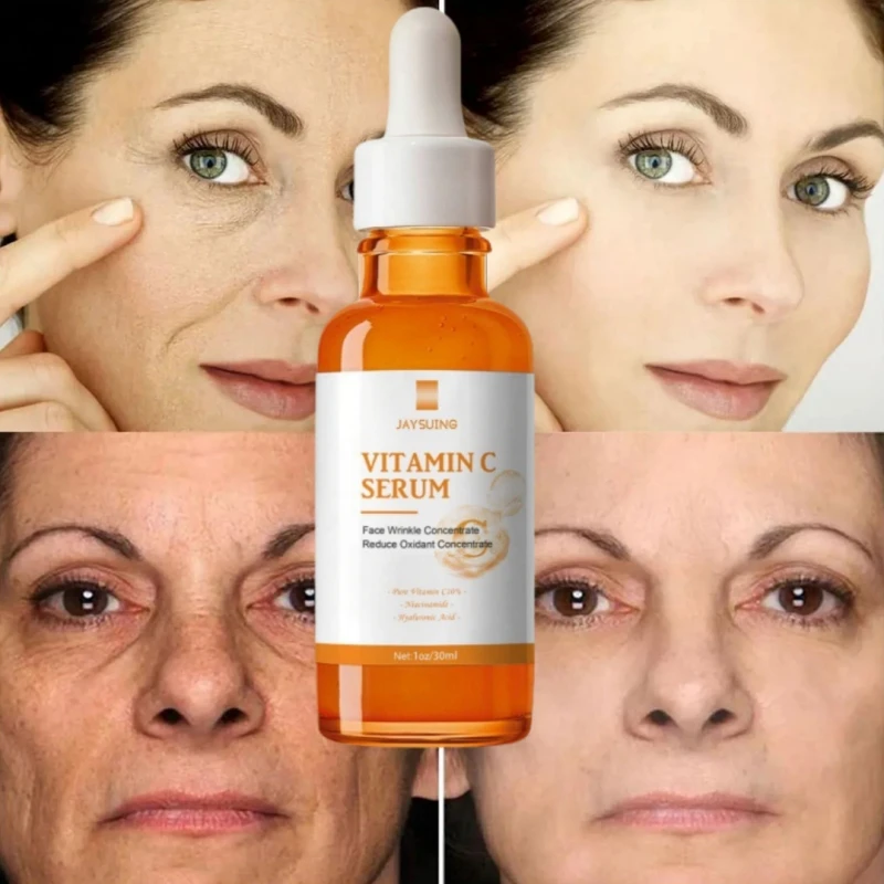 Vitamin C Whitening Serum Face Remove Dark Spots Freckle Melasma Fade Skin Melanin Retinol Anti Aging Essence Brighten Skin Care