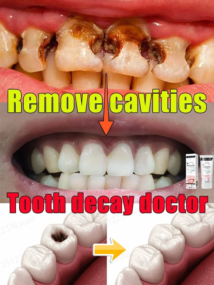 Repair tooth decay, remove plaque and periodontitis.