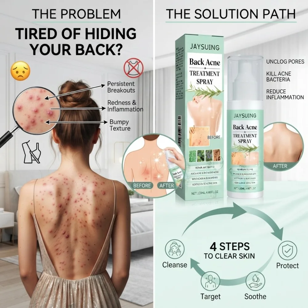 120ml Herbal Back Shoulder Soothing Spray Refreshing Mist Smooth Bumpy Skin Sensitive Skin Friendly Daily Body Care Lotion - view 3