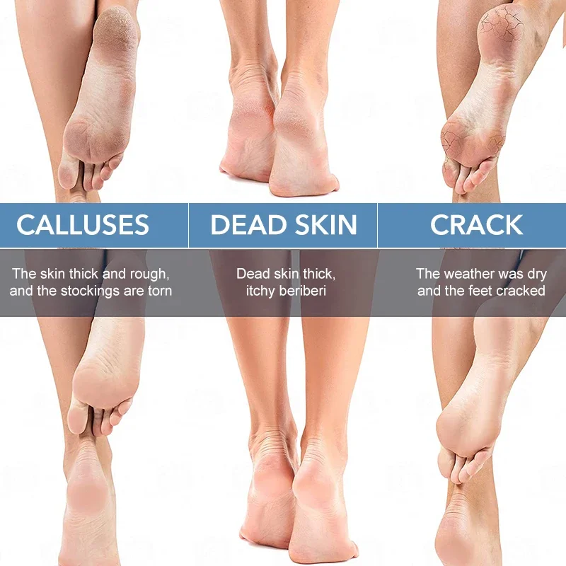 Broyeur de pieds en verre Nano, lime pour les pieds, dissolvant de callosités de peau morte, épurateur de pieds, râpe pour talon, exfoliante, outils de pédicure, soins des pieds