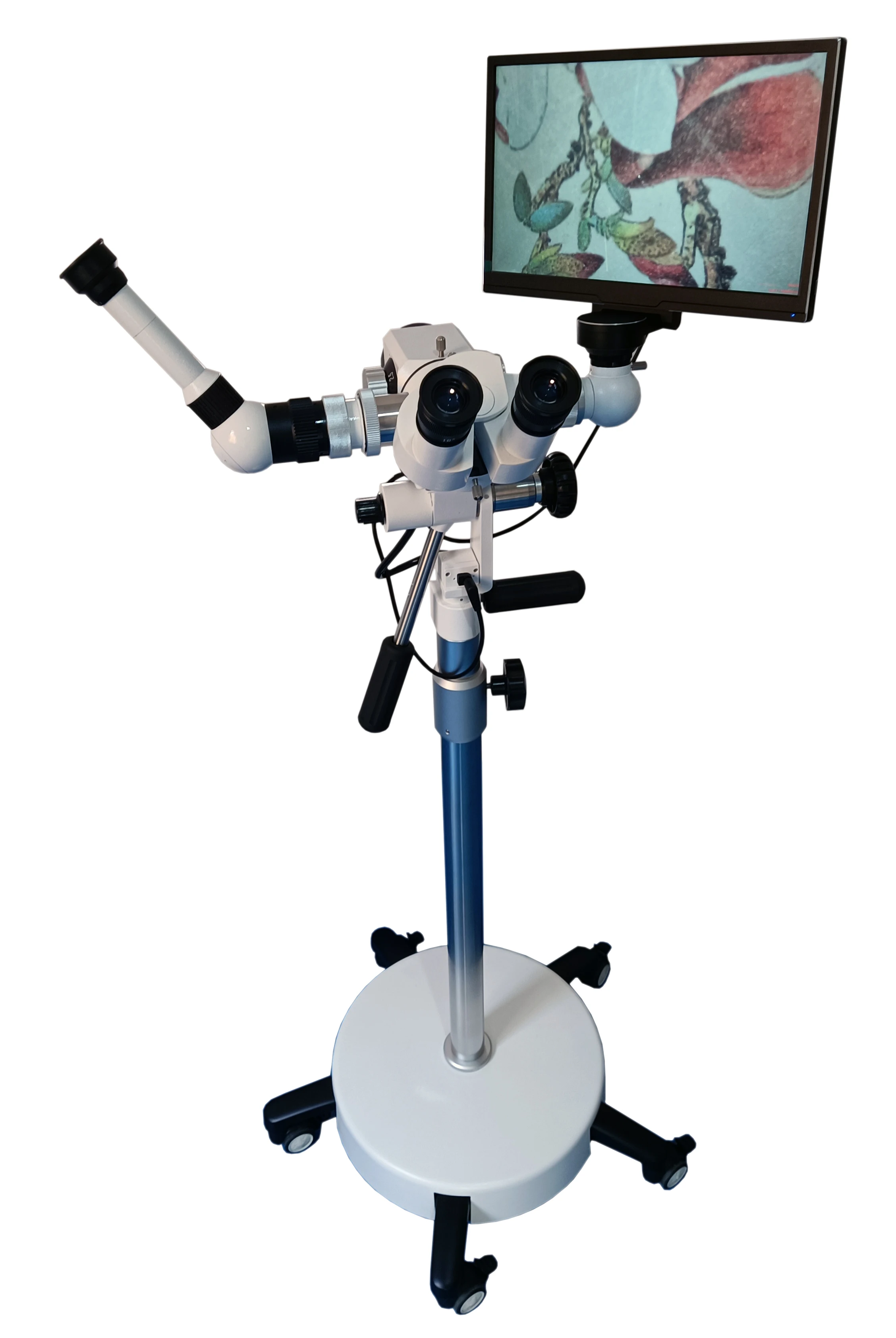 Medical Endoscopic Vaginal Digital Stand-up Colposcopy Instruments Portable Video Colposcopy